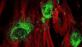 科学家利用声波将干细胞转化为骨细胞 实现了再生的突破